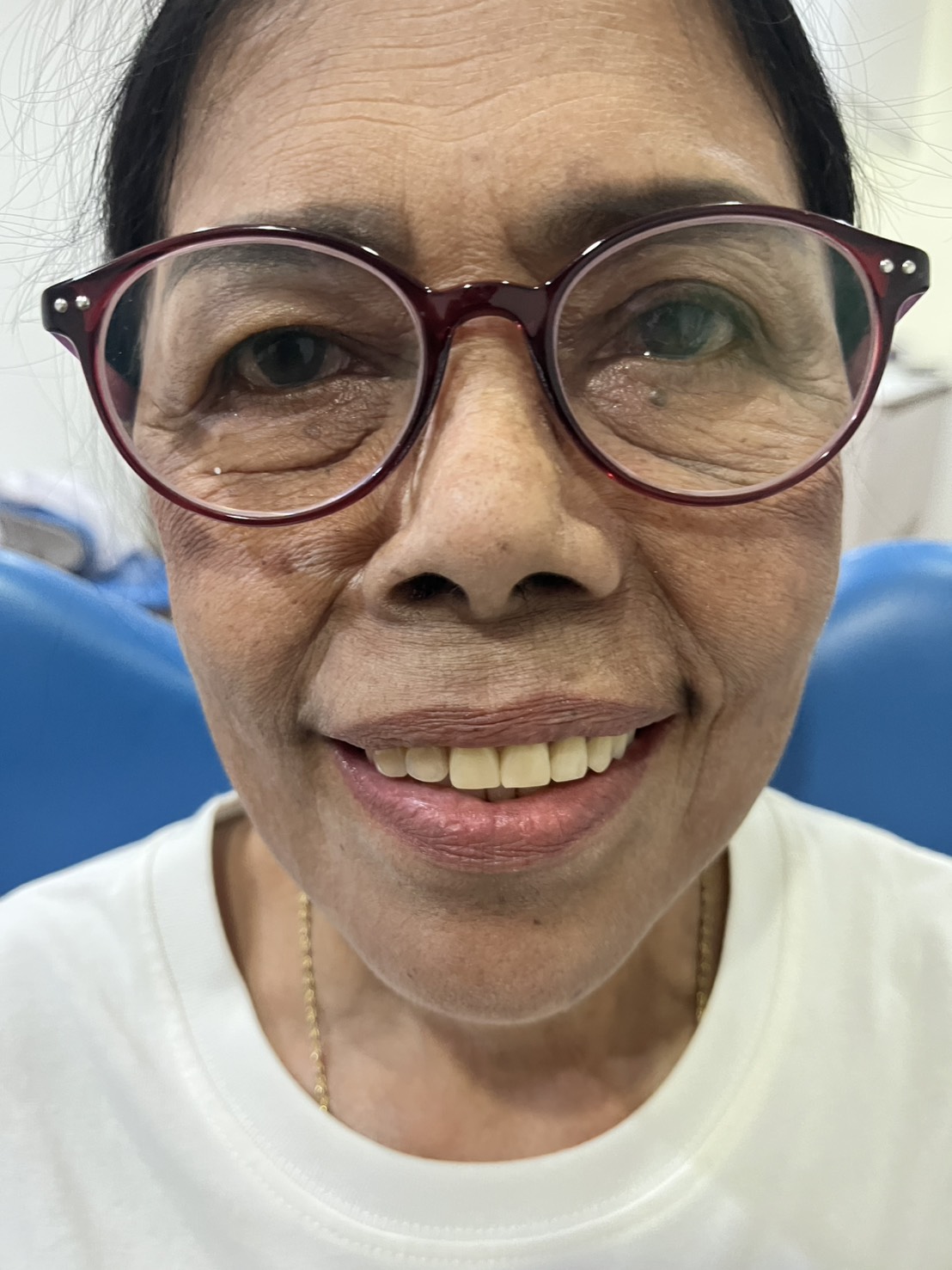 คนไข้มีความสุขและพึงพอใจกับรอยยิ้มใหม่