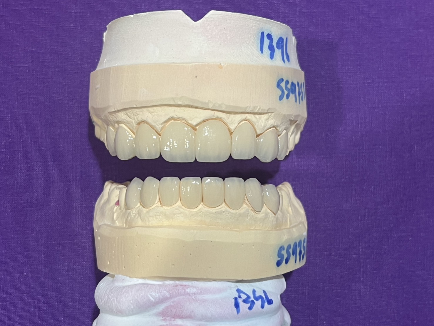ห้องทรีตเมนต์สะอาดเป็นสัดส่วน
